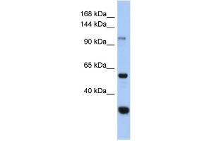 WB Suggested Anti-GANC Antibody Titration: 0. (GANC anticorps  (Middle Region))