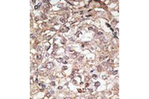 Image no. 2 for anti-Toll-Like Receptor 1 (TLR1) (C-Term) antibody (ABIN357041) (TLR1 anticorps  (C-Term))