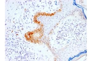 Formalin-fixed, paraffin-embedded human Skin stained with Cytokeratin 15 Rabbit Recombinant Monoclonal Ab (KRT15/2103R).