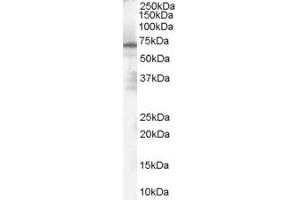 Western Blotting (WB) image for anti-Chromosome 16 Open Reading Frame 78 (C16orf78) (N-Term) antibody (ABIN2785051) (C16orf78 anticorps  (N-Term))