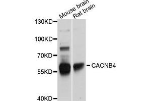 Western blot analysis of extracts of various cells, using CACNB4 antibody. (CACNB4 anticorps)