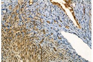 ABIN6257358 and ABIN6273564 at 1/100 staining Rat ovary tissue by IHC-P. (Myocardin anticorps  (Internal Region))