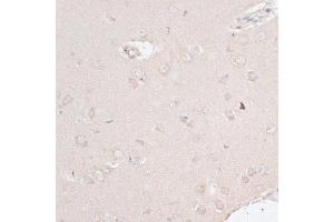 Immunohistochemistry of paraffin-embedded rat brain using ABCF2 antibody (ABIN6291735) at dilution of 1:100 (40x lens). (ABCF2 anticorps)