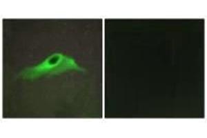 Immunofluorescence analysis of HeLa cells, using Collagen IV α5 antibody. (COL4a5 anticorps)