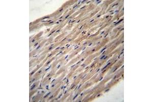 Immunohistochemistry analysis in formalin fixed and paraffin embedded human heart tissue reacted with PLOD1 / PLOD Antibody (N-term) followed which was peroxidase conjugated to the secondary antibody and followed by DAB staining. (PLOD1 anticorps  (N-Term))
