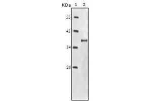 Western blot analysis using IGF1R-Beta mouse mAb against truncated IGF1R-Beta recombinant protein. (IGF1R-beta anticorps)