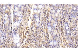 Detection of RARS in Human Small intestine Tissue using Monoclonal Antibody to Arginyl tRNA Synthetase (RARS)