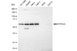 Western blotting analysis using PPP3CA antibody (ABIN7800026).