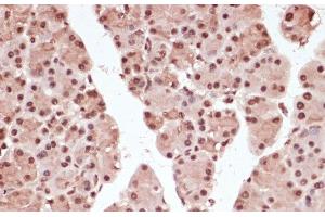 Immunohistochemistry of paraffin-embedded Rat pancreas using Phospho-ATF2(T71) Polyclonal Antibody at dilution of 1:100 (40x lens). (ATF2 anticorps  (pThr71))