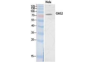 Western Blotting (WB) image for anti-2'-5'-Oligoadenylate Synthetase 2, 69/71kDa (OAS2) (Internal Region) antibody (ABIN3181072) (OAS2 anticorps  (Internal Region))