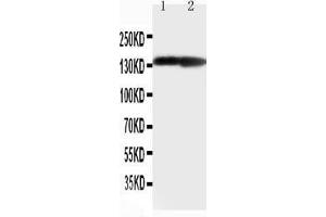 Anti-Collagen II antibody, Western blotting Lane 1: Rat Heart Tissue Lysate Lane 1: Rat Brain Tissue Lysate (COL2A1 anticorps  (C-Term))
