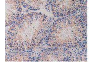 IHC-P analysis of Mouse Testis Tissue, with DAB staining. (PDGFRB anticorps  (AA 337-583))