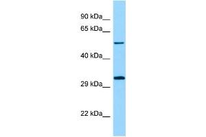 WB Suggested Anti-STK33 Antibody Titration: 1. (STK33 anticorps  (N-Term))