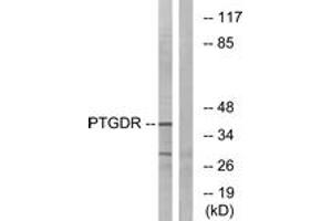 Western blot analysis of extracts from HepG2 cells, using PTGDR Antibody. (PTGDR anticorps  (AA 263-312))