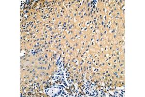 Immunohistochemistry of paraffin embedded human tonsil using IFIT5 (ABIN7074334) at dilution of 1:500 (300x lens) (IFIT5 anticorps)