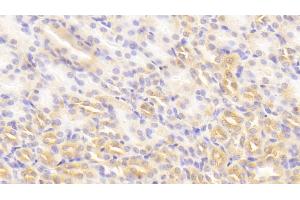 Detection of PKLR in Mouse Kidney Tissue using Polyclonal Antibody to Pyruvate kinase isozymes R/L (PKLR)