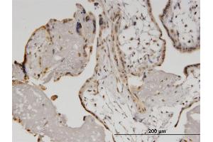 Immunoperoxidase of monoclonal antibody to HELZ on formalin-fixed paraffin-embedded human placenta.