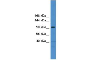 WB Suggested Anti-TRAK1  Antibody Titration: 0. (TRAK1 anticorps  (Middle Region))