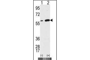 Western blot analysis of Vimentin (arrow) using Vimentin Antibody (Center) (ABIN389213 and ABIN2839368).