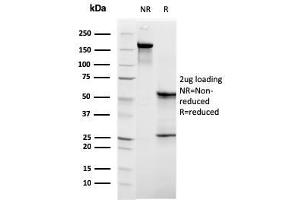 SDS-PAGE Analysis Purified C1QB Mouse Monoclonal Antibody (C1QB/2961). (C1QB anticorps  (AA 41-188))