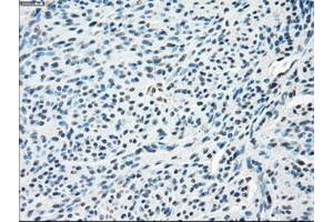 Image no. 1 for anti-Solute Carrier Family 2 (Facilitated Glucose/fructose Transporter), Member 5 (SLC2A5) antibody (ABIN1498472)