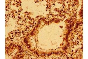 Immunohistochemistry of paraffin-embedded human lung tissue using ABIN7160437 at dilution of 1:100