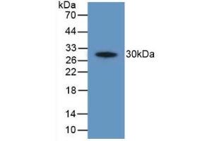 Detection of Recombinant PTGS2, Human using Polyclonal Antibody to Cyclooxygenase-2 (COX 2)
