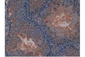 IHC-P analysis of Mouse Testis Tissue, with DAB staining. (FLT4 anticorps  (AA 30-326))