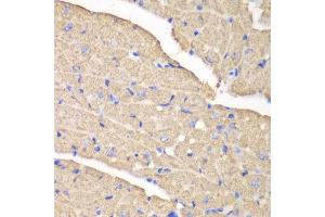 Immunohistochemistry (IHC) image for anti-Voltage-Dependent Anion Channel 1 (VDAC1) (AA 1-283) antibody (ABIN6213993) (VDAC1 anticorps  (AA 1-283))