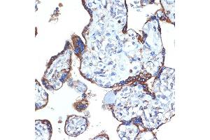 Immunohistochemistry of paraffin-embedded human placenta using ERp29 Rabbit mAb (ABIN7266943) at dilution of 1:100 (40x lens). (ERP29 anticorps)