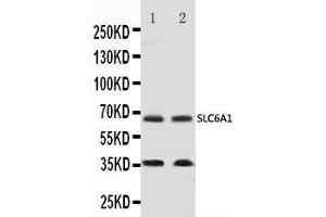 Anti-GABA Transporter 1/GAT 1 antibody, Western blotting Lane 1: Rat Brain Tissue Lysate Lane 2: Mouse Brain Tissue Lysate (SLC6A1 anticorps  (C-Term))