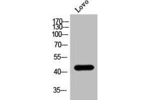 Western Blot analysis of Lovo cells using Phospho-MOR-1 (S375) Polyclonal Antibody (Mu Opioid Receptor 1 anticorps  (pSer375))