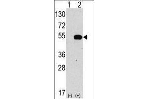Western blot analysis of anti-hG4C-Y48 Pab 1810a in 293 cell line lysates transiently transfected with the ATG4C gene (2 μg/lane). (ATG4C anticorps  (N-Term))