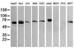 Image no. 7 for anti-RIO Kinase 2 (RIOK2) (AA 277-552) antibody (ABIN1491305) (RIOK2 anticorps  (AA 277-552))