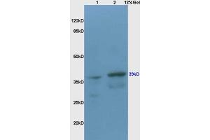 Lane 1: rat brain lysates Lane 2: mouse heart lysates probed with Anti CX3CR1 Polyclonal Antibody, Unconjugated (ABIN733583) at 1:200 in 4 °C.