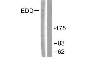 Western blot analysis of extracts from A549 cells, using EDD antibody. (UBR5 anticorps)
