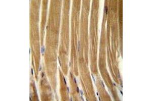 Caspase-5 antibody immunohistochemistry analysis in formalin fixed and paraffin embedded human skeletal muscle.