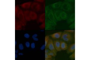 Mitofusin 2 Mouse Monoclonal Antibody staining Hela cells by IF/ICC. (MFN2 anticorps)