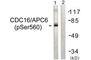 Western blot analysis of extracts from HuvEc cells, using CDC16/APC6 (Phospho-Ser560) Antibody. (CDC16 anticorps  (pSer560))
