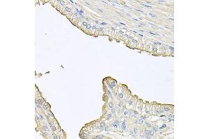 Immunohistochemistry of paraffin-embedded human prostate using FABP12 antibody. (FABP12 anticorps)
