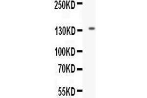 Western blot analysis of EGF expression in mouse kidney extract (lane 1). (EGF anticorps  (AA 977-1029))