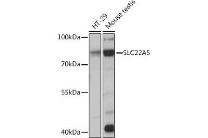 Western blot analysis of extracts of various cell lines, using SLC22 Rabbit pAb (ABIN3022378, ABIN3022379, ABIN3022380, ABIN1513530 and ABIN6218770) at 1:1000 dilution. (SLC22A5 anticorps  (AA 1-180))