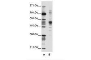 Image no. 1 for anti-Coronin, Actin Binding Protein, 1A (CORO1A) (C-Term) antibody (ABIN202576) (Coronin 1a anticorps  (C-Term))