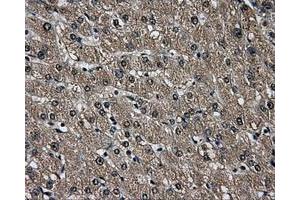 Immunohistochemical staining of paraffin-embedded liver tissue using anti-AKR1A1mouse monoclonal antibody. (AKR1A1 anticorps)