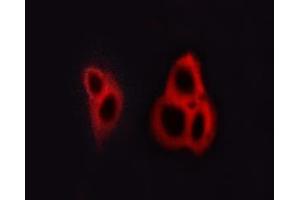 ABIN6267615 staining A549 cells by ICC/IF. (GRIN1/NMDAR1 anticorps  (pSer890))