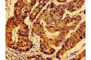 anti-AHSA2P (AA 1-137) antibody