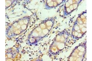 Immunohistochemistry of paraffin-embedded human colon tissue using ABIN7154111 at dilution of 1:100 (GSTM4 anticorps  (AA 1-218))
