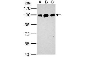 WB Image Sample (30 ug of whole cell lysate) A: Neuro2A B: GL261 C: C8D30 7.