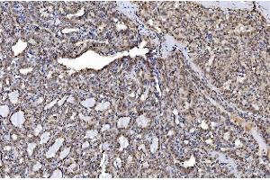 IHC analysis of Aurora A/AURKA using anti-Aurora A/AURKA antibody (ABIN7599581). (Aurora A anticorps  (AA 1-97))