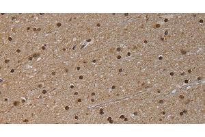 Immunohistochemistry of paraffin-embedded Human brain tissue using NLRP6 Polyclonal Antibody at dilution 1:50 (NLRP6 anticorps)